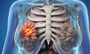 kk