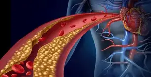 hiperkolestrol