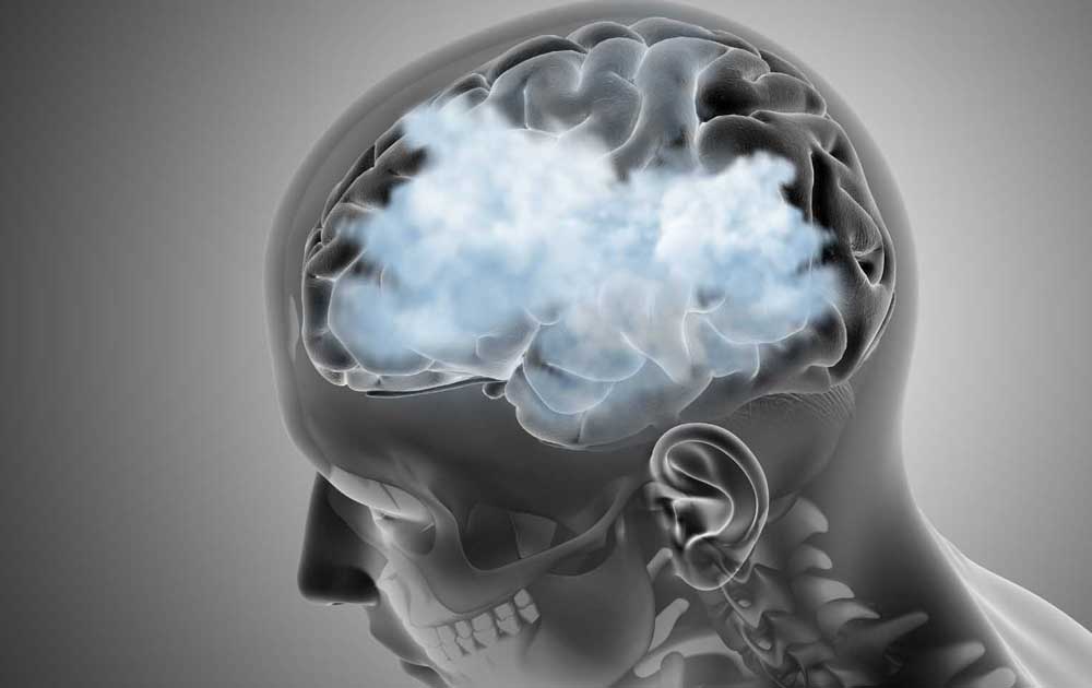 brain fog